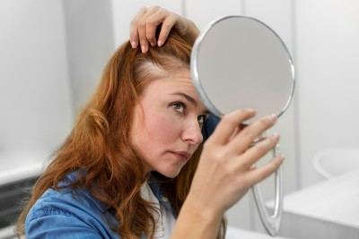 Nem csak a férfiakat érinti: a hajhullás okai